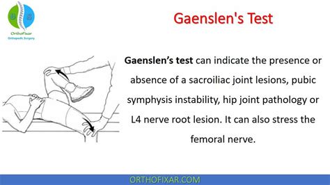 gaenslen's test for sprain